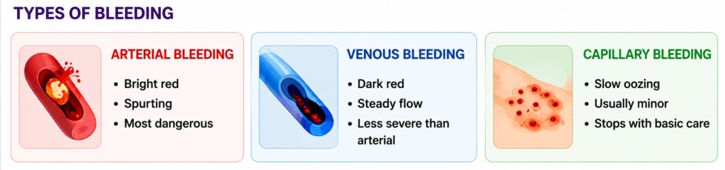 Infographic comparing the three types of bleeding—arterial, venous, and capillary—highlighting their appearance, blood flow characteristics, and severity in first aid.
