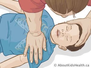 Rescuer performing chest compressions on an unresponsive child while maintaining an open airway during child CPR.